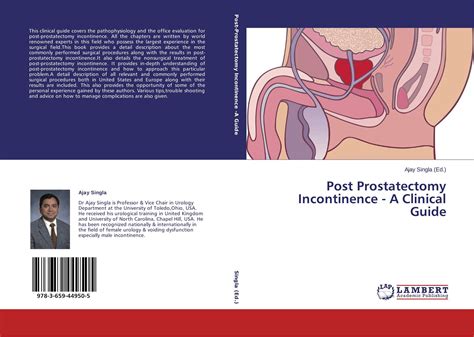 Post Prostatectomy Incontinence A Clinical Guide