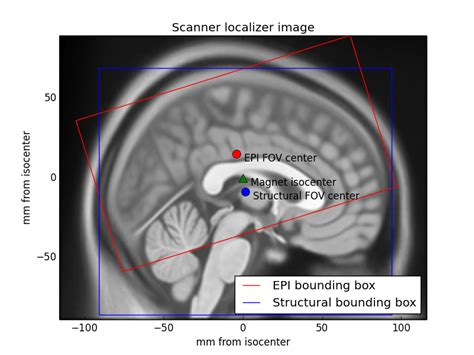 Brain Imaging Png What Is Fmri Center For Functional Mri Uc San Diego