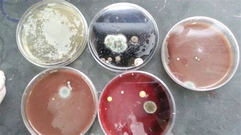 Fungal Contaminated Various Culture Plates Youtube