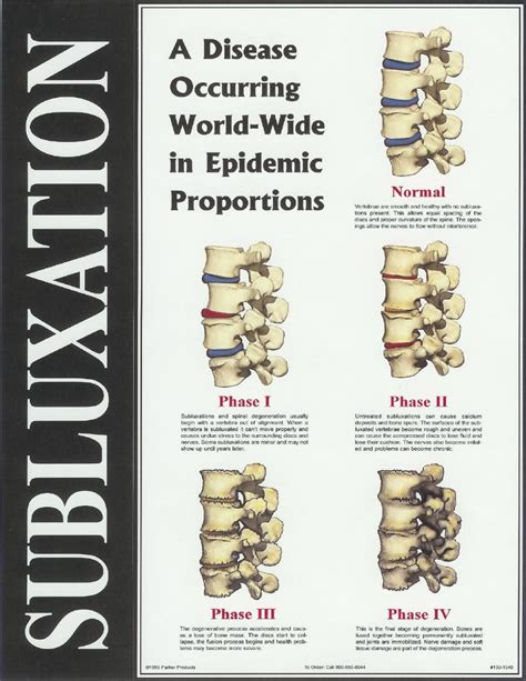The Phases Of Subluxation Chiropractic Care Spine Health Upper Cervical Chiropractic