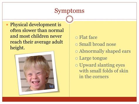 Ppt Down Syndrome Powerpoint Presentation Free Download Id2171604