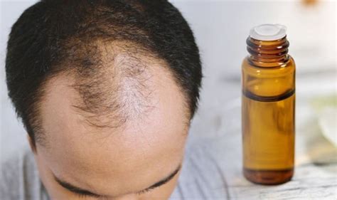 Hailed as a healthy home. Hair loss treatment: Using tea tree essential oil could ...