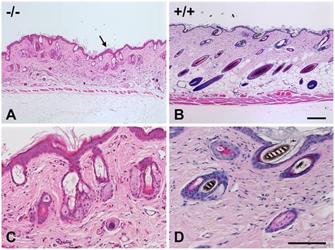 Skin Histopathology Of The Affected Mice Skin Of An Affected Mouse At