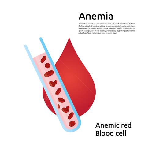 Anemia Iron Red Blood Cell Medical Vector Illustration Anemia Blood