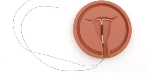The Coil Iud Pros And Cons