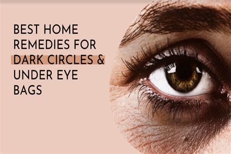Best Home Remedies For Dark Circles And Under Eye Bags