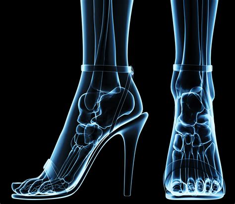 Images Skeleton Legs Closeup High Heels X