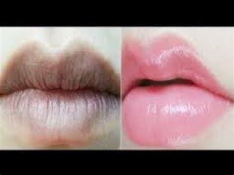 After Using Thislips Will Look Naturally Pink Plump Soft You Will