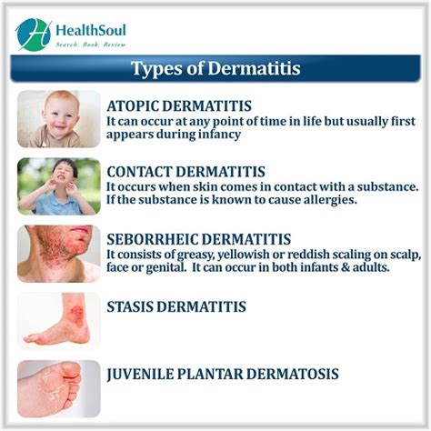 Dermatitis Overview Causes Symptoms Diagnosis And Management