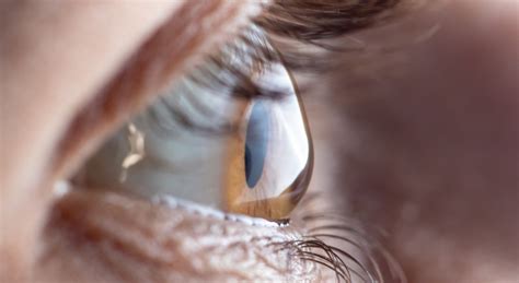 Your Blurry Vision Could Be Caused By Astigmatism Optometrist In