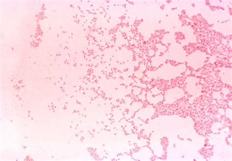 Gram staining helps doctors make a diagnosis, but can it also help suggest a cure? موقع الدكتور أحمد كلحى: صور باكتيريا - Bacteria slides ...