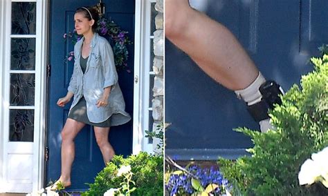 Allison Mack Wears Ankle Monitoring Bracelet In First Photos Of Nxivm