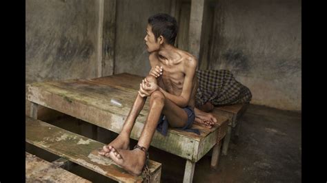 In Indonesia Mentally Il Shackled In Filthy Cells Cnn