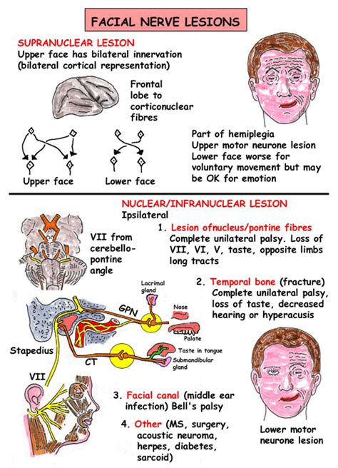 Instant Anatomy Head And Neck Nerves Cranial Vii Lesions Dental