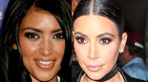 Kim Kardashians Plastic Surgery Timeline Before And After Surgery Hair And Beauty Heat