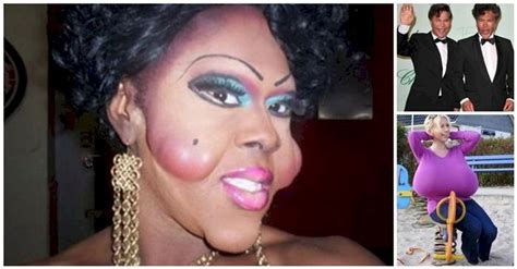 24 Plastic Surgeries Gone Wrong Very Wrong Plastic Surgery Gone