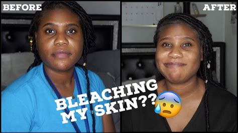 Am I Bleaching My Skin Underneath Skincare Update Youtube