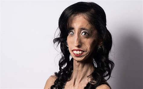 How World S Ugliest Woman Turned Tables On Tormentors