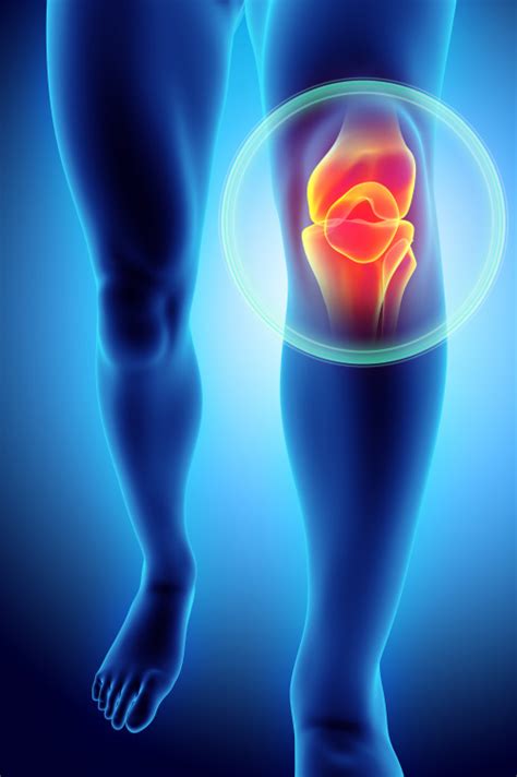 Osteoarthritis Knee Treatment Study Vantage Clinical Trials