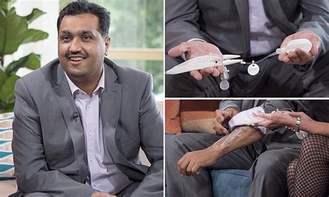 Mohammed Abad With A Bionic Penis Had An Erection For Two Weeks After