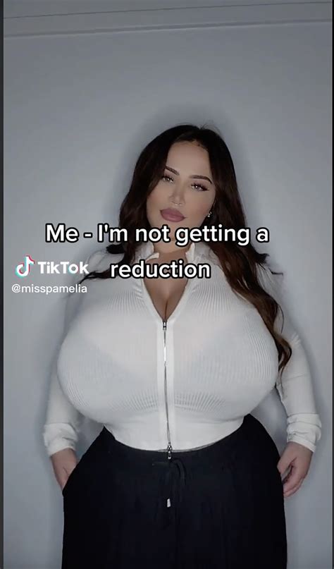 My Boobs Won T Stop Growing I Have A Rare Condition