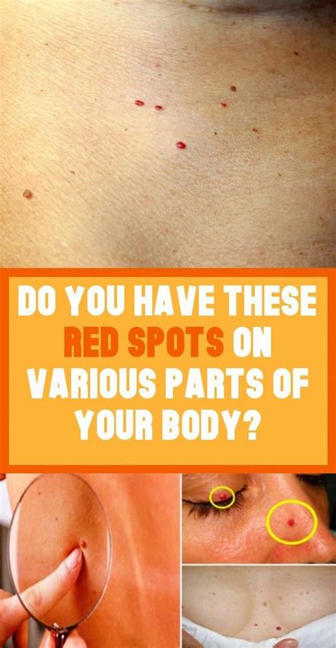 Why Do I Have Red Spots On My Body Frequently Asked Questions