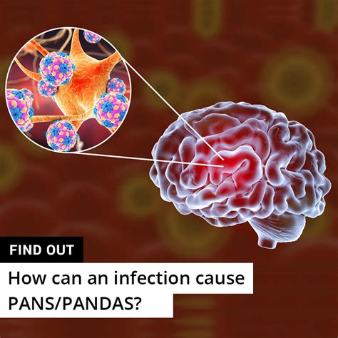 Pandas Pans What Is Pans Moleculera Labs