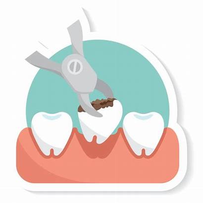 Tooth Extraction Extractions Dental Clipart Removal Socket