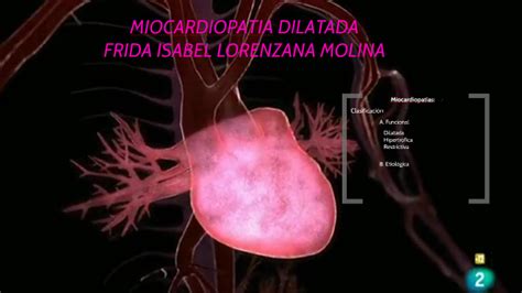 Adriana 's insurance, more options, no contracts, just savings. MIOCARDIOPATIA DILATADA by adrian reyes on Prezi Next