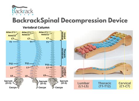 Yoga Treatment Back Pain Archives Spinal Backrack