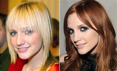 Ashley Simpson Before And After Celebrity Surgery Celebrity Plastic
