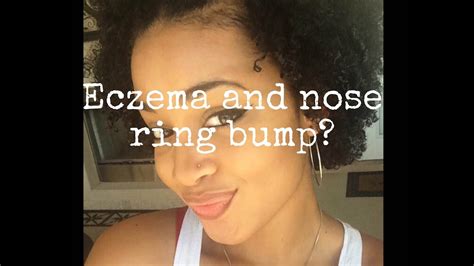 Are you experiencing a piercing bump? How to Get Rid Of Eczema and Nose Ring Bump/Keloids - YouTube