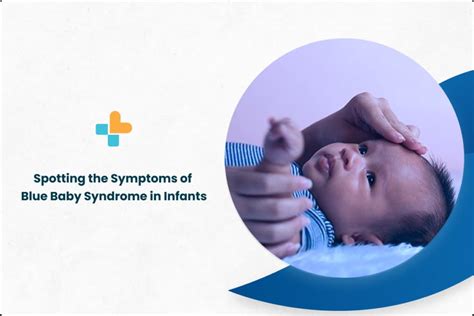 Spotting The Symptoms Of Blue Baby Syndrome In Infants