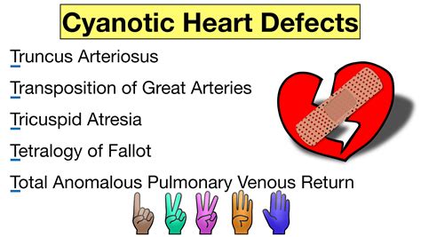 Congenital Heart Diseases Cyanotic Defects Made Easy — Ezmed