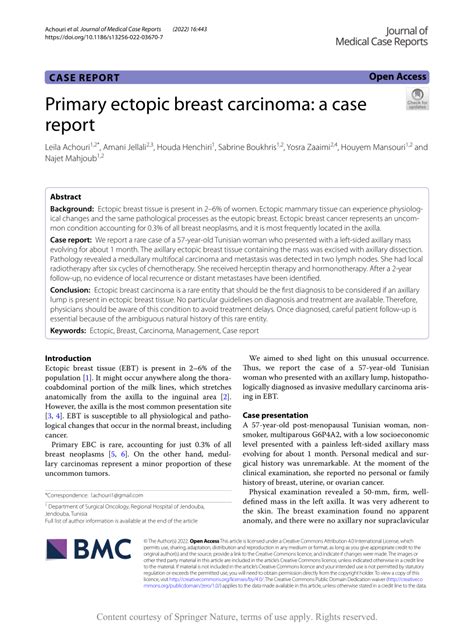 Pdf Primary Ectopic Breast Carcinoma A Case Report