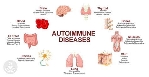 Pin On Auto Immune Diseases