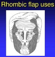 Transposition Rx Surgical