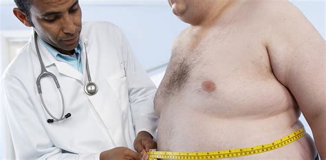 Surpoids et obésité LPG Medical