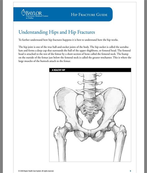 Post Hip Fracture Surgery Patient Teaching Hip Fracture Teaching