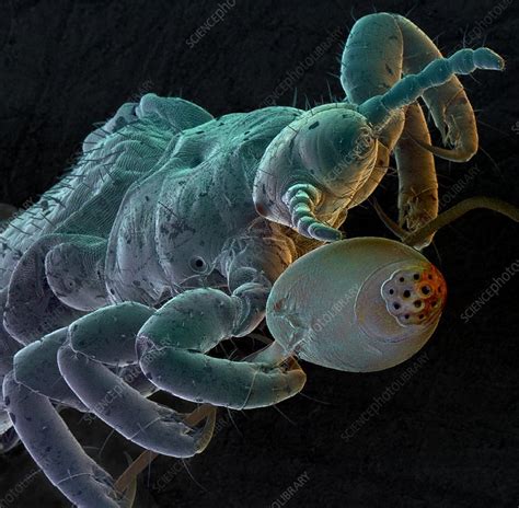 Human Head Louse With Egg Stock Image Z Science Photo Library