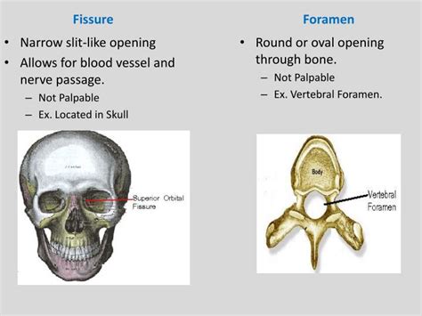 PPT - Bone Markings PowerPoint Presentation - ID:3346559