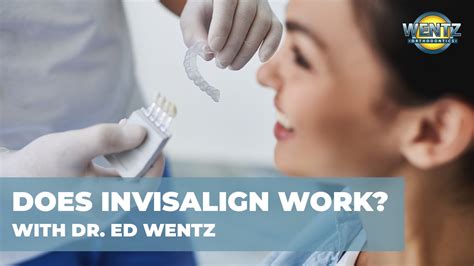 Start your free online quote and save $610. Does Invisalign Work? | Wentz Orthodontics