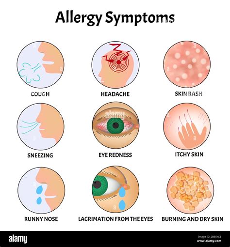 Symptoms Of Allergies Skin Rash Allergic Skin Itching Tearing From