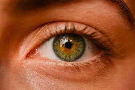 Ocular Nevi Are Eye Freckles Dangerous Step To Health