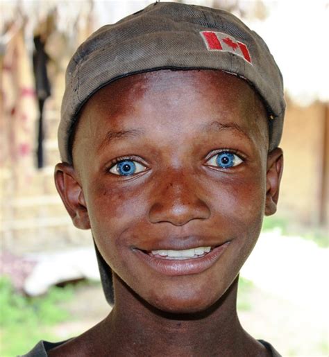 Curly black hair and blue eyes. Acting White Acting Black: Blue Eyed African Boy From ...