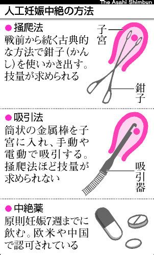 朝日新聞デジタル日本の中絶母体に重い負担 WHOが勧める方法1割 社会