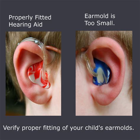 How To Put In A Childs Hearing Aid Hubpages