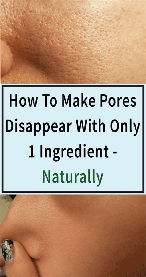 How To Make Pores Disappear With Only 1 Ingredient Naturally In 2020
