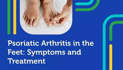 Psoriatic Arthritis In The Feet Symptoms And Treatment Mypsoriasisteam