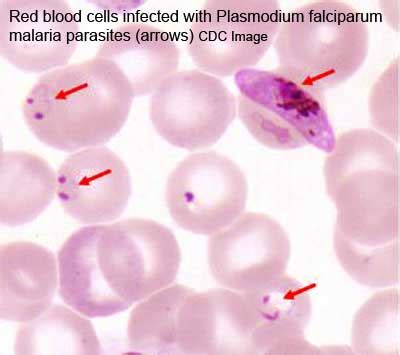 File Malaria Plasmodium Falciparum Embryology